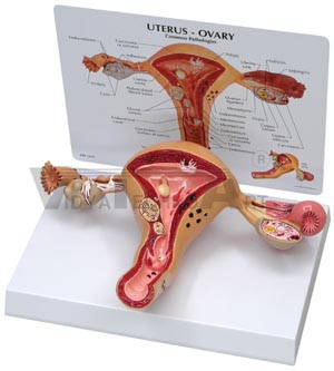 Uterus